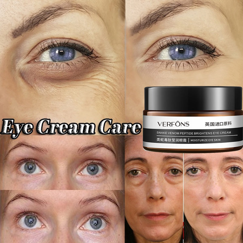 Ridules anneau pour les yeux soin des yeux hydratant Essence masque pour les yeux lait